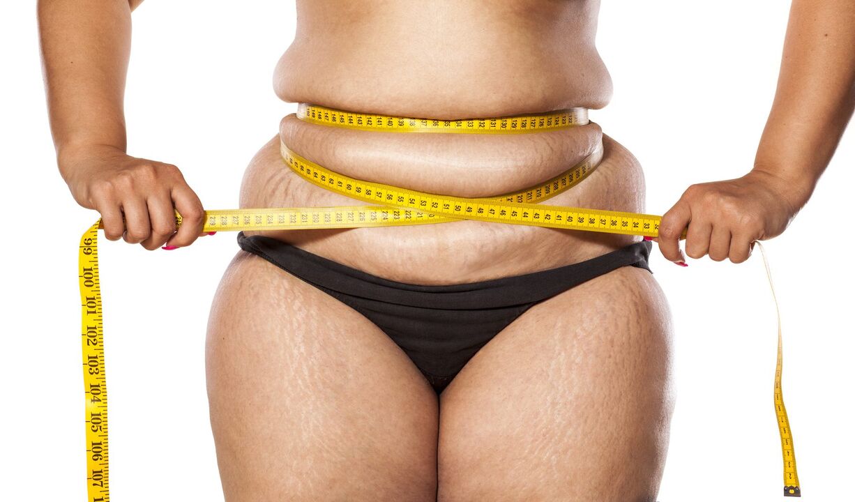 Overmatig gewicht en gewichtsverlies met Keto Probiotix